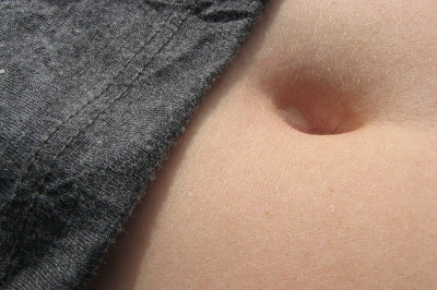 Policistični jajnici